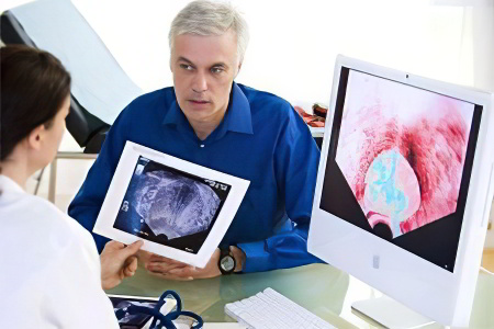 атеросклероз атеросклероз