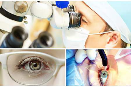 Лечение астигматизма Лечение астигматизма