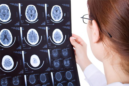 лечения наружной гидроцефалии лечения наружной гидроцефалии