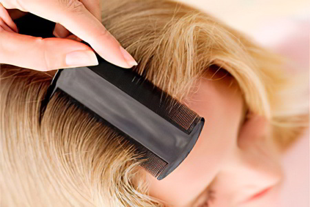 Лечение педикулеза Лечение педикулеза