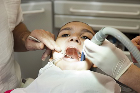 Лечение свища десны Лечение свища десны