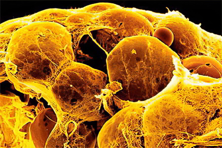 липиды липиды