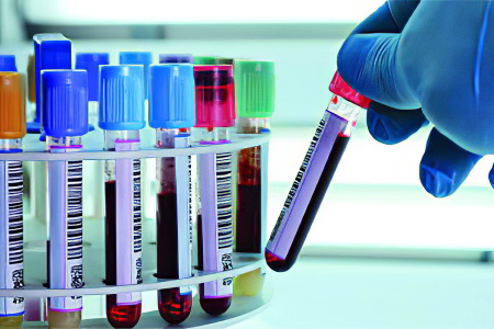 Магний Магний