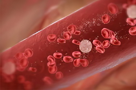 Малокровие Малокровие