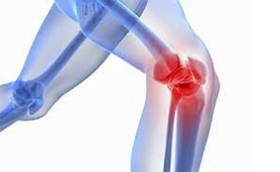 Менископатии Менископатии