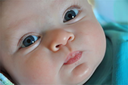 Мешки под глазами у грудного ребёнка Мешки под глазами у грудного ребёнка