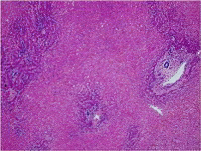 некроз некроз