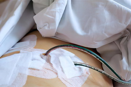 Неоперабельный рак желудка Неоперабельный рак желудка