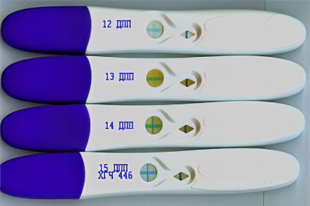 Общие причины получения недостоверного результата Общие причины получения недостоверного результата