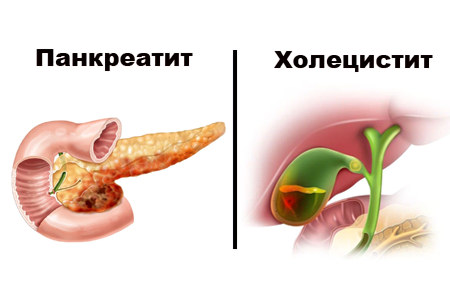 Заболевания не связанные с поражением желудка Заболевания не связанные с поражением желудка