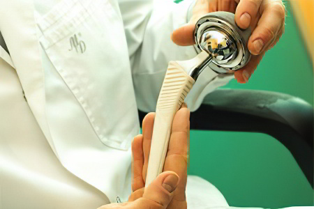 Операция при коксартрозе Операция при коксартрозе