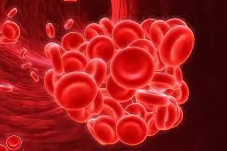 Осложнения варикоза Осложнения варикоза