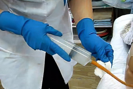 Осложнения послеоперационного периода Осложнения послеоперационного периода