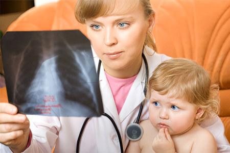 Особенности течения заболевания у детей Особенности течения заболевания у детей