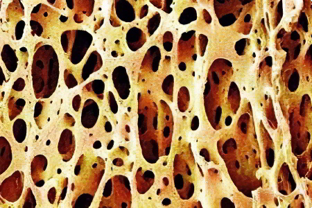 Остеокальцин Остеокальцин