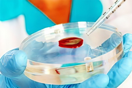 Диагностика остеомиелита Диагностика остеомиелита