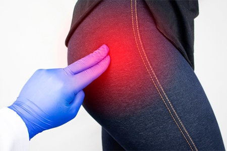 Боль в ягодицах Боль в ягодицах