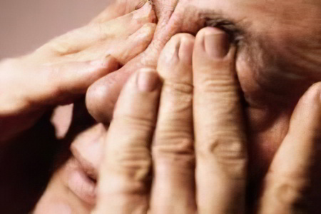 Ожог глаз Ожог глаз