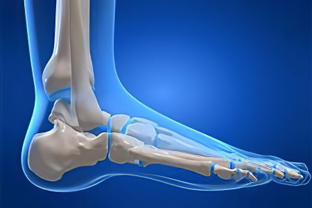 Перелом лодыжки ноги Перелом лодыжки ноги