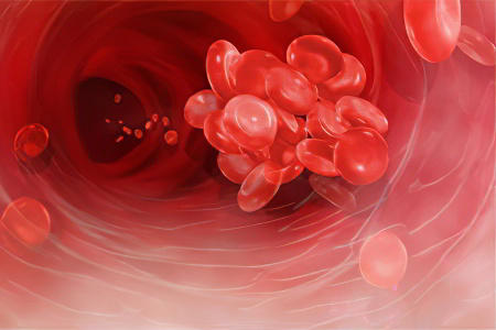 Пернициозная анемия Пернициозная анемия