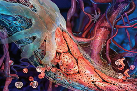 Почему забиваются сосуды Почему забиваются сосуды