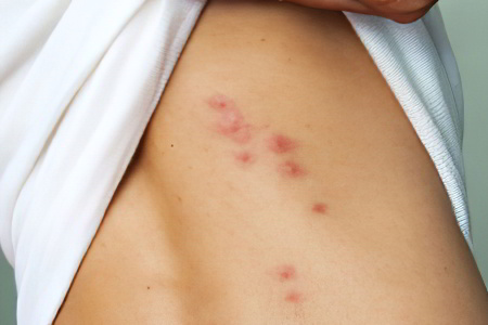 Почему появляются пятна на ногах Почему появляются пятна на ногах