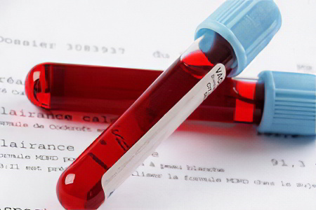 Показатели нормы АЧТВ Показатели нормы АЧТВ