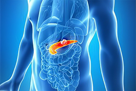 Полип поджелудочной железы Полип поджелудочной железы