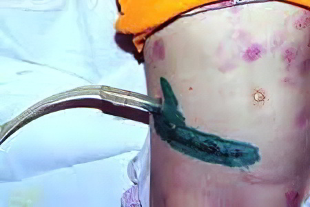 Последствия Последствия