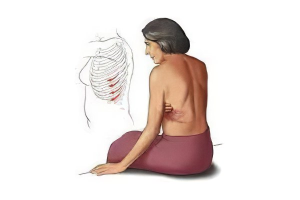 Последствия Последствия