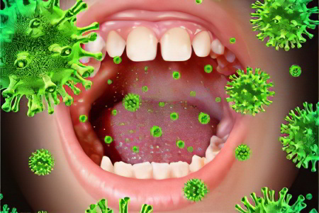 Причины гонококкового фарингита Причины гонококкового фарингита