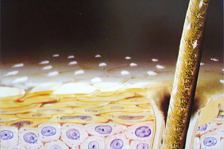 Причины перхоти Причины перхоти