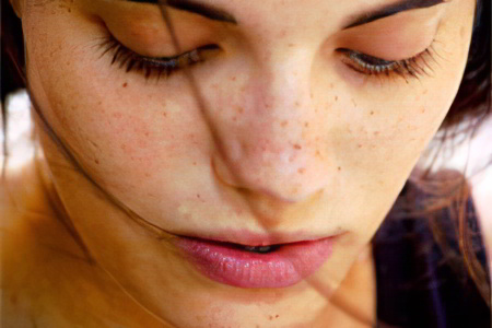 Причины появления пигментных пятен Причины появления пигментных пятен