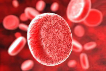 Причины сгущения крови Причины сгущения крови