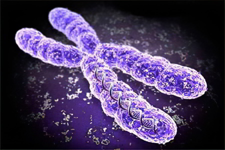 Причины синдрома Тернера Причины синдрома Тернера