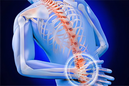 Причины анкилозирующего Причины анкилозирующего