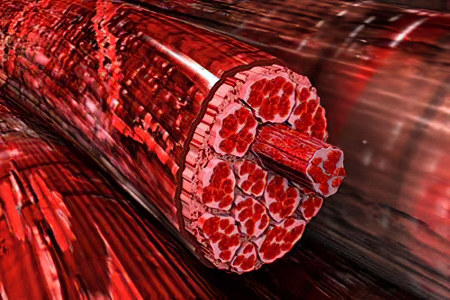 Причины боли в мышцах Причины боли в мышцах