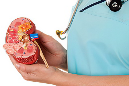 Причины формирования липомы почки Причины формирования липомы почки