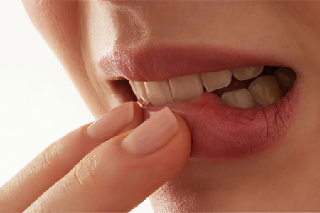 Причины герпетического стоматита Причины герпетического стоматита