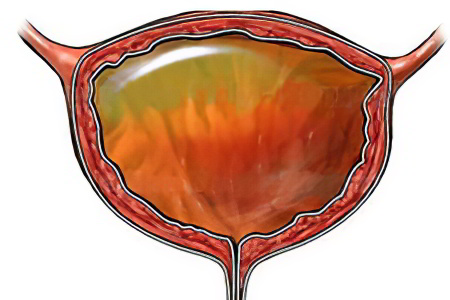 Причины возникновения Причины возникновения