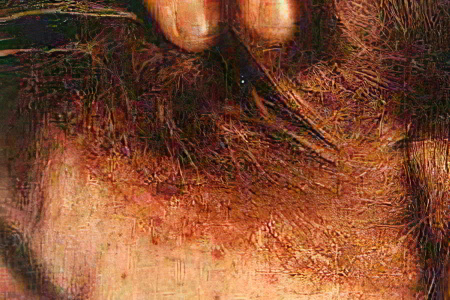 Причины появления вшей на голове Причины появления вшей на голове