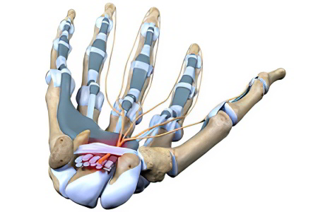 Причины развития синдрома Причины развития синдрома