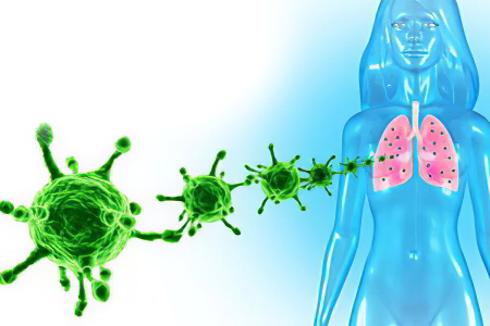 Причины саркоидоза лёгких Причины саркоидоза лёгких