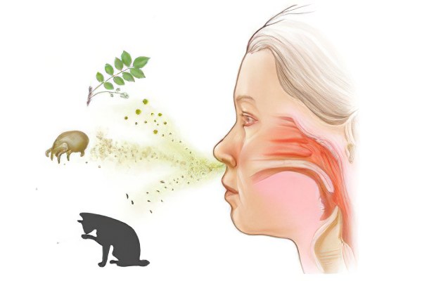 Причины аллергического фарингита Причины аллергического фарингита