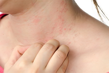 Проблемы с кожей Проблемы с кожей