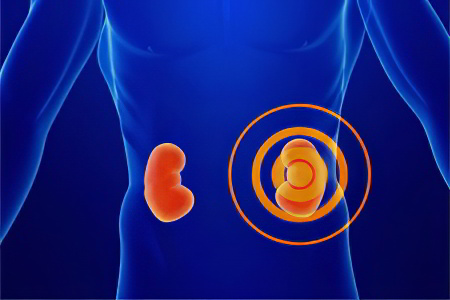 Профилактика гломерулонефрита Профилактика гломерулонефрита