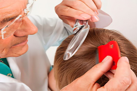 Профилактика педикулёза Профилактика педикулёза