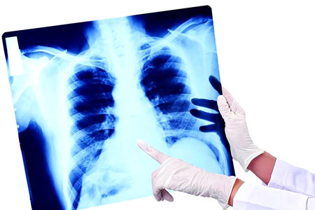 Что проверяет врач Что проверяет врач