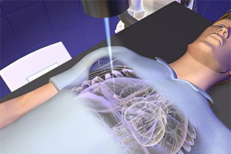 Радиохирургическая Радиохирургическая