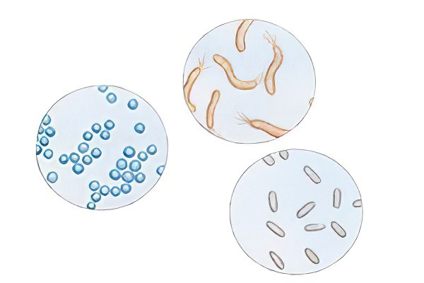 Причины ревматоидного артрита Причины ревматоидного артрита